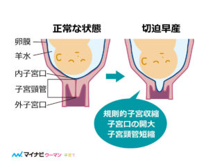 妊娠29週 35週のエコー写真と体調 妊娠33週で切迫早産になり37週で出産 Hitomiブログ